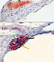 Aortic Injury Induced by Benzo(a)pyrene and Atherogenic Diet Increased Hepatic FGF21 Expression in C57BL/6J Mice