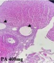 Therapeutic Effects of Pimpinella anisum Fruit Extract on Polycystic Ovary Syndrome in a Rat Model: Emerging Role of Inflammatory Responses and Oxidative Stress