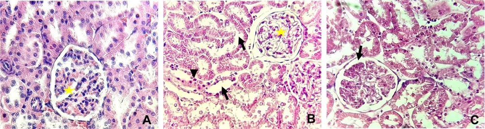 Histopathological alterations in the kidney in different groups examined by hematoxylin and eosin staining (X400). (A) The control group showing normal glomeruli (yellow star), (B) rats received 25 mg/kg of silica nanoparticles (SiNPs) showing marked interstitial fibrosis with mononuclear inflammatory cell aggregation (arrowhead), tubular degeneration (arrow), and glomerulonephritis (yellow star). In addition to these manifestations, (C) rats received 100 mg/kg of SiNPs showing glomerular atrophy (arrow). Histopathological alterations in the kidney in different groups examined by hematoxylin and eosin staining (X400). (A) The control group showing normal glomeruli (yellow star), (B) rats received 25 mg/kg of silica nanoparticles (SiNPs) showing marked interstitial fibrosis with mononuclear inflammatory cell aggregation (arrowhead), tubular degeneration (arrow), and glomerulonephritis (yellow star). In addition to these manifestations, (C) rats received 100 mg/kg of SiNPs showing glomerular atrophy (arrow).