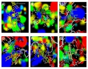 Understanding the Molecular Landscape of Endometriosis: A Bioinformatics Approach to Uncover Signaling Pathways and Hub Genes