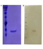 RadioLabeling of the Mutant form of Anti-PlGF Nanobody by 99mTc-Tricarbonyl
