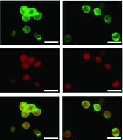 Selection and Characterization of a DNA Aptamer Recognizing High Mobility Group Box 1 Protein (HMGB1) and Enhancing Its Pro-inflammatory Activity