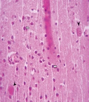 Cover image of the article: Efficacy of Clindamycin in Preventing Abortion and Vertical Transmission of Toxoplasma gondii (PRU Strain) Infection in Pregnant BALB/c Mice