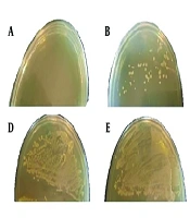 Evaluation of Antimicrobial Activity of Novel Chimeric M-PEX12 Peptide Against Acinetobacter baumannii