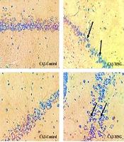 The Impact of Coenzyme Q10 on Cognitive Dysfunction, Antioxidant Defense, Cholinergic Activity, and Hippocampal Neuronal Damage in Monosodium Glutamate-Induced Obesity