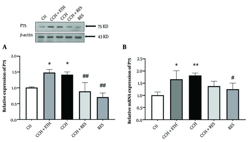 P75 expression – the protein (A) and mRNA (B) expression levels of P75 in the hippocampus were assessed in the following groups: Control (Ctl), chronic cerebral hypoperfusion (CCH), CCH + ethanol (ETH), CCH + resveratrol (RES) and RES. Results were normalized to β-actin expression. Data are expressed as mean ± SEM (n = 6); * P < 0.05 and ** P < 0.01 vs. Ctl, # P < 0.05 and ## P < 0.01 vs. CCH group. P75 expression – the protein (A) and mRNA (B) expression levels of P75 in the hippocampus were assessed in the following groups: Control (Ctl), chronic cerebral hypoperfusion (CCH), CCH + ethanol (ETH), CCH + resveratrol (RES) and RES. Results were normalized to β-actin expression. Data are expressed as mean ± SEM (n = 6); * P < 0.05 and ** P < 0.01 vs. Ctl, # P < 0.05 and ## P < 0.01 vs. CCH group.