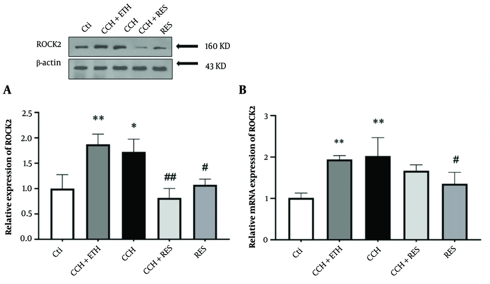 Rock2 expression – the protein (A) and mRNA (B) expression levels of ROCK2 in the hippocampus were assessed in the following groups: Control (Ctl), chronic cerebral hypoperfusion (CCH), CCH + ethanol (ETH), CCH + resveratrol (RES) and RES. Results were normalized to β-actin expression. Data are expressed as mean ± SEM (n = 6); * P < 0.05 and ** P < 0.01 vs. Ctl, # P < 0.05 and ## P < 0.01 vs. CCH. Rock2 expression – the protein (A) and mRNA (B) expression levels of ROCK2 in the hippocampus were assessed in the following groups: Control (Ctl), chronic cerebral hypoperfusion (CCH), CCH + ethanol (ETH), CCH + resveratrol (RES) and RES. Results were normalized to β-actin expression. Data are expressed as mean ± SEM (n = 6); * P < 0.05 and ** P < 0.01 vs. Ctl, # P < 0.05 and ## P < 0.01 vs. CCH.