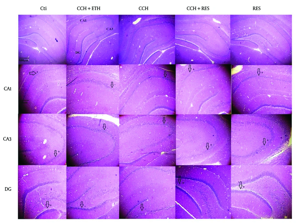 H&E staining in the CA1, CA3 and dentate gyrus (DG) of the rat hippocampus – neuronal death in the hippocampus was assessed in the following groups: Control (Ctl), chronic cerebral hypoperfusion (CCH), CCH + ethanol (ETH), CCH + resveratrol (RES) and RES groups. In the Ctl group, the cytoplasm is stained, and the nuclei are not fragmented in CA1, CA3 and DG. However, neurons are degenerated, and the nuclei are dense in CA1, CA3 and DG in the CCH and CCH + ETH groups. Resveratrol prevented CCH-induced neuronal death in the hippocampus. (Magnification 40X, 400X, scale bar = 200 µm or 50 µm). H&E staining in the CA1, CA3 and dentate gyrus (DG) of the rat hippocampus – neuronal death in the hippocampus was assessed in the following groups: Control (Ctl), chronic cerebral hypoperfusion (CCH), CCH + ethanol (ETH), CCH + resveratrol (RES) and RES groups. In the Ctl group, the cytoplasm is stained, and the nuclei are not fragmented in CA1, CA3 and DG. However, neurons are degenerated, and the nuclei are dense in CA1, CA3 and DG in the CCH and CCH + ETH groups. Resveratrol prevented CCH-induced neuronal death in the hippocampus. (Magnification 40X, 400X, scale bar = 200 µm or 50 µm).