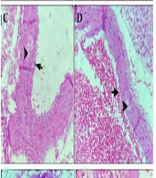 Protective Effects of Berberine-Loaded Black Seed (Nigella sativa L.) Oil Nanoemulsion in the Atherosclerotic Mouse Model