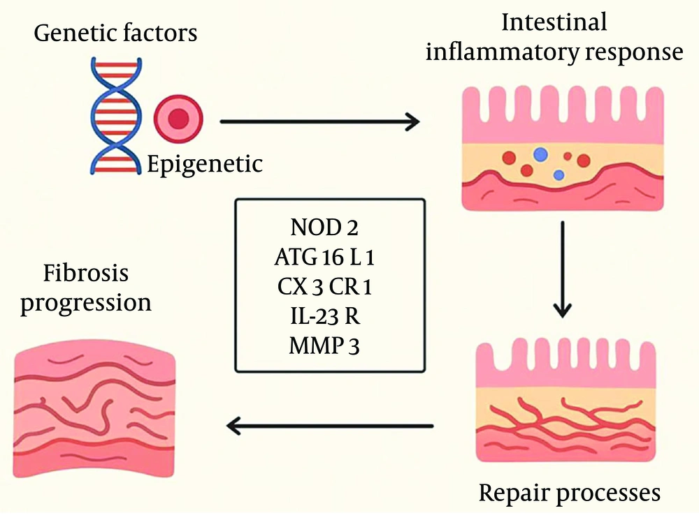 Genetic and epigenetic factors, along with microbiota interactions, influence inflammation and repair in Crohn’s disease (CD). Variants in genes such as NOD2, ATG16L1, and toll-like receptor 4 (TLR4) are linked to fibrosis and strictures. Genetic and epigenetic factors, along with microbiota interactions, influence inflammation and repair in Crohn’s disease (CD). Variants in genes such as NOD2, ATG16L1, and toll-like receptor 4 (TLR4) are linked to fibrosis and strictures.