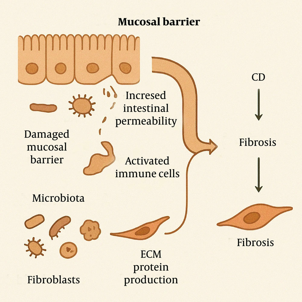 In Crohn’s disease (CD), disruption of the mucosal barrier and gut microbiota imbalance increase intestinal permeability, activate immune and stromal cells, and promote fibroblast-driven extracellular matrix (ECM) production, contributing to fibrosis. In Crohn’s disease (CD), disruption of the mucosal barrier and gut microbiota imbalance increase intestinal permeability, activate immune and stromal cells, and promote fibroblast-driven extracellular matrix (ECM) production, contributing to fibrosis.