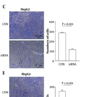 Serine Protease Inhibitor 1 (SERPINE1) Regulates Epithelial-Mesenchymal Transition Gene Expression to Promote Migration and Invasion in Hepatocellular Carcinoma