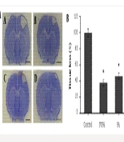 Combined Omega-3 Fatty Acid and Folic Acid Supplementation Reduces Neonatal Hypoxic-Ischemic Brain Injury via Anti-inflammatory and Anti-apoptotic Mechanisms