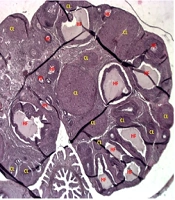 IDO Inhibition by 1-Methyltryptophan: Unlocking New Paths to Treat Ovarian Dysfunction and Hormonal Imbalance in PCOS