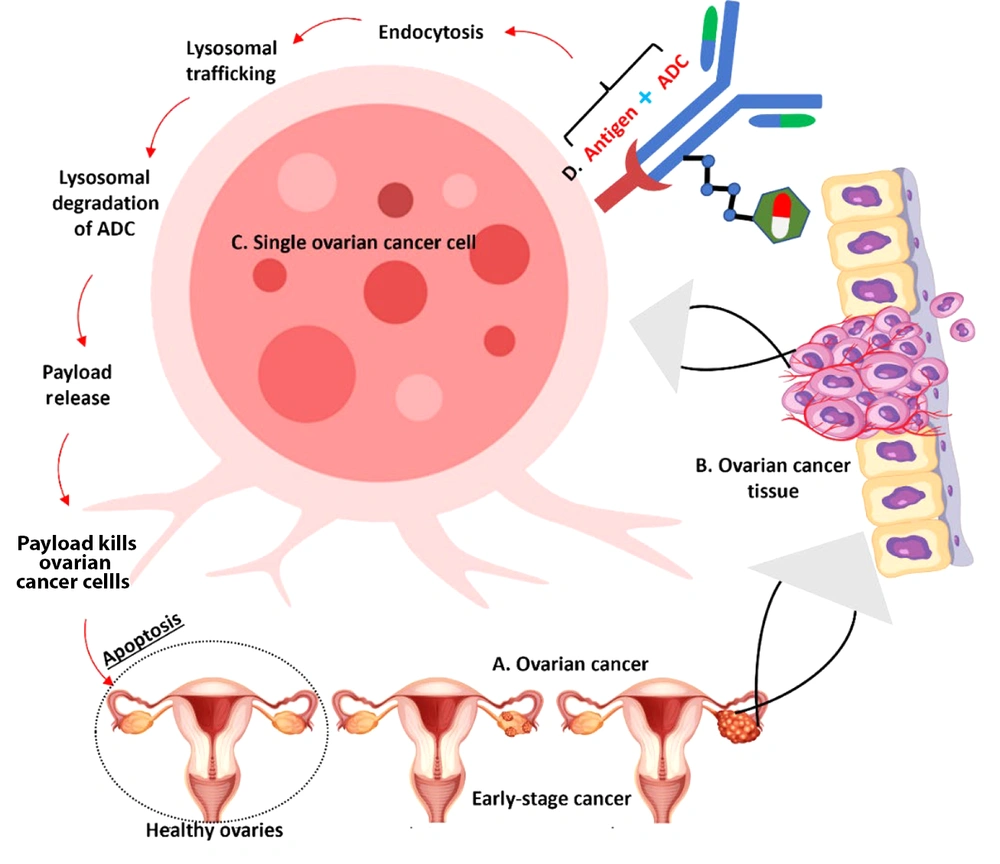 Molecular Mechanism of action of antibody-drug conjugates (ADCs) in targeting ovarian cancer cells – the illustration demonstrates the progression from healthy to cancerous ovarian tissue and the mechanism of action of ADCs: A, ovarian cancer development showing progression from healthy ovaries to early-stage cancer; B, ovarian cancer tissue showing tumor formation; C, enlarged view of a single ovarian cancer cell demonstrating the detailed mechanism; D, ADC binding to target antigen on the cell surface. Molecular Mechanism of action of antibody-drug conjugates (ADCs) in targeting ovarian cancer cells – the illustration demonstrates the progression from healthy to cancerous ovarian tissue and the mechanism of action of ADCs: A, ovarian cancer development showing progression from healthy ovaries to early-stage cancer; B, ovarian cancer tissue showing tumor formation; C, enlarged view of a single ovarian cancer cell demonstrating the detailed mechanism; D, ADC binding to target antigen on the cell surface.