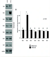 Acylglycerol Kinase 2-mediated Inhibition of Sirtuin 2 Restores AMPK/AKT/mTOR Signaling Balance in Podocytes: A Pharmacological Strategy for Diabetic Nephropathy