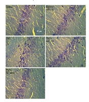 Promising Therapeutic Potential of miR-220-3p Mimic Against Murine Trimethyltin Hippocampal Injury