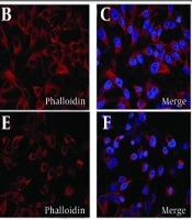 In vitro Multi-targeted Anti-cancer Effects of Bavachinin in Papillary Thyroid Carcinoma Cell Line: Dual Pathway Inhibition and Cytokine Downregulation