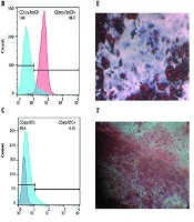 miR-146a-Enriched Extracellular Vesicles Attenuate Neuroinflammation and Promote Recovery After Ischemic Stroke