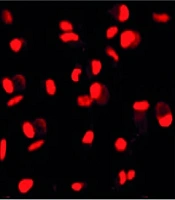 Anti-inflammation and Anti-insulin Resistance of a Compound from Vietnamese Clerodendrum chinense Leaves