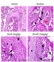 Anti-osteoporotic Effect of Solanum xanthocarpum Leaf Extract on Retinoic Acid-induced Osteoporosis in Rats via Alleviating Osteoclastic Activity