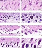Dendrobium officinale Polysaccharide Promotes Infected Wound Healing Through SIRT1-Regulated HMGB1-K29 Deacetylation and NF-κB Inhibition