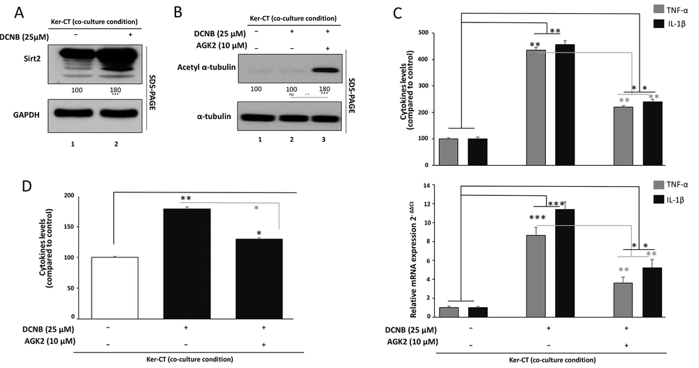 Involvement of SIRT2 in DNCB-induced inflammatory and oxidative stress responses A, SIRT2 protein levels in Ker-CT keratinocytes in transwell co-culture treated with DNCB (24 h) were assessed by Western blotting; GAPDH served as the loading control and densitometry was normalized to vehicle control. B, Functional target engagement was evaluated by acetylated α-tubulin (Ac-α-tubulin) accumulation after DNCB ± AGK2 treatment; total α-tubulin was used for normalization. C, Inflammatory responses were assessed by TNF-α and IL-1β mRNA levels (RT-qPCR; normalized to GAPDH) and secreted protein levels (ELISA) following DNCB ± AGK2. D, ROS generation was measured by DCFDA fluorescence following DNCB ± AGK2 and normalized to vehicle control. Data are mean ± SD from ≥ 3 independent biological experiments (n ≥ 3). Statistical testing: one-way ANOVA with Tukey’s post hoc test. Significance: *P < 0.05, **P < 0.01, ***P < 0.001. Where shown, horizontal comparison bars denote statistical contrasts (black bars: vs vehicle control; grey bars: vs DNCB alone). Involvement of SIRT2 in DNCB-induced inflammatory and oxidative stress responses A, SIRT2 protein levels in Ker-CT keratinocytes in transwell co-culture treated with DNCB (24 h) were assessed by Western blotting; GAPDH served as the loading control and densitometry was normalized to vehicle control. B, Functional target engagement was evaluated by acetylated α-tubulin (Ac-α-tubulin) accumulation after DNCB ± AGK2 treatment; total α-tubulin was used for normalization. C, Inflammatory responses were assessed by TNF-α and IL-1β mRNA levels (RT-qPCR; normalized to GAPDH) and secreted protein levels (ELISA) following DNCB ± AGK2. D, ROS generation was measured by DCFDA fluorescence following DNCB ± AGK2 and normalized to vehicle control. Data are mean ± SD from ≥ 3 independent biological experiments (n ≥ 3). Statistical testing: one-way ANOVA with Tukey’s post hoc test. Significance: *P < 0.05, **P < 0.01, ***P < 0.001. Where shown, horizontal comparison bars denote statistical contrasts (black bars: vs vehicle control; grey bars: vs DNCB alone).
