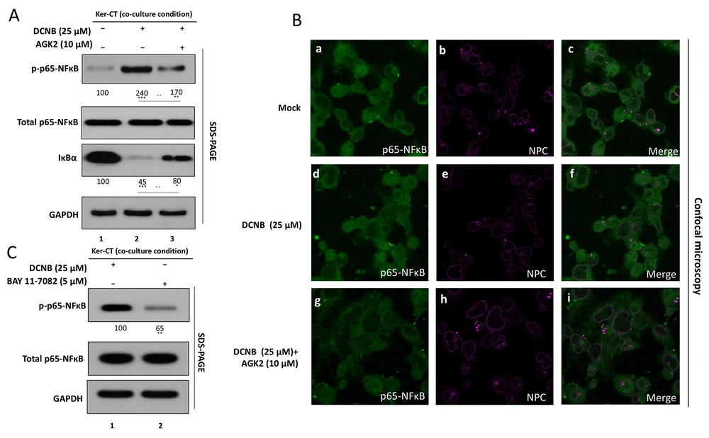 SIRT2 inhibition attenuates DNCB-induced NF-κB activation in Ker-CT keratinocytes A, NF-κB activation was assessed by Western blotting for phospho-p65 (Ser536) and total p65, presented as p-p65/p65 ratio, and for IκBα abundance following DNCB ± AGK2 treatment. Densitometric quantification was performed from ≥ 3 independent experiments and normalized to vehicle control. B, NF-κB p65 subcellular localization was assessed by immunofluorescence/confocal microscopy; representative images are shown and nuclear/cytoplasmic fluorescence ratios were quantified. C, Pharmacological validation using BAY 11 - 7082: p-p65/p65 ratios were compared across DNCB-treated groups with AGK2 or BAY 11 - 7082 by immunoblot and densitometry. Data are mean ± SD from ≥ 3 independent biological experiments (n ≥ 3). Statistical testing: one-way ANOVA with Tukey’s post hoc test. Significance: **P < 0.01. Where shown, horizontal comparison bars denote statistical contrasts (black bars: vs vehicle control; grey bars: vs DNCB alone). SIRT2 inhibition attenuates DNCB-induced NF-κB activation in Ker-CT keratinocytes A, NF-κB activation was assessed by Western blotting for phospho-p65 (Ser536) and total p65, presented as p-p65/p65 ratio, and for IκBα abundance following DNCB ± AGK2 treatment. Densitometric quantification was performed from ≥ 3 independent experiments and normalized to vehicle control. B, NF-κB p65 subcellular localization was assessed by immunofluorescence/confocal microscopy; representative images are shown and nuclear/cytoplasmic fluorescence ratios were quantified. C, Pharmacological validation using BAY 11 - 7082: p-p65/p65 ratios were compared across DNCB-treated groups with AGK2 or BAY 11 - 7082 by immunoblot and densitometry. Data are mean ± SD from ≥ 3 independent biological experiments (n ≥ 3). Statistical testing: one-way ANOVA with Tukey’s post hoc test. Significance: **P < 0.01. Where shown, horizontal comparison bars denote statistical contrasts (black bars: vs vehicle control; grey bars: vs DNCB alone).