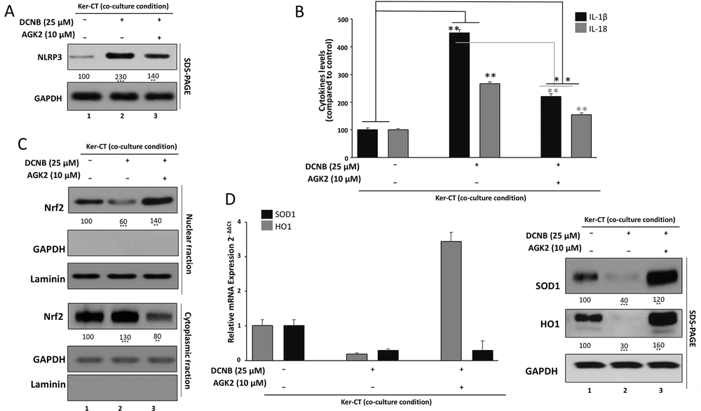 SIRT2 inhibition suppresses NLRP3 inflammasome priming–associated responses and restores Nrf2-dependent antioxidant signaling A, NLRP3 expression was assessed by Western blotting in Ker-CT keratinocytes treated with DNCB ± AGK2; densitometry was normalized to vehicle control. B, IL-1β and IL-18 secretion in culture supernatants was quantified by ELISA following DNCB ± AGK2. C, Nrf2 localization was assessed by nuclear–cytoplasmic fractionation and Western blotting; nuclear and cytoplasmic Nrf2 were normalized to Lamin B1 and GAPDH, respectively, and expressed as nuclear-to-cytoplasmic (N/C) ratio. D, Antioxidant outputs were assessed by HO-1 and SOD expression at mRNA level (RT-qPCR; normalized to GAPDH) and protein level (Western blot; densitometry normalized to vehicle control). Data are mean ± SD from ≥ 3 independent biological experiments (n ≥ 3). Statistical testing: one-way ANOVA with Tukey’s post hoc test. Significance: *P < 0.05, **P < 0.01, ***P < 0.001. Where shown, horizontal comparison bars denote statistical contrasts (black bars: vs vehicle control; grey bars: vs DNCB alone). SIRT2 inhibition suppresses NLRP3 inflammasome priming–associated responses and restores Nrf2-dependent antioxidant signaling A, NLRP3 expression was assessed by Western blotting in Ker-CT keratinocytes treated with DNCB ± AGK2; densitometry was normalized to vehicle control. B, IL-1β and IL-18 secretion in culture supernatants was quantified by ELISA following DNCB ± AGK2. C, Nrf2 localization was assessed by nuclear–cytoplasmic fractionation and Western blotting; nuclear and cytoplasmic Nrf2 were normalized to Lamin B1 and GAPDH, respectively, and expressed as nuclear-to-cytoplasmic (N/C) ratio. D, Antioxidant outputs were assessed by HO-1 and SOD expression at mRNA level (RT-qPCR; normalized to GAPDH) and protein level (Western blot; densitometry normalized to vehicle control). Data are mean ± SD from ≥ 3 independent biological experiments (n ≥ 3). Statistical testing: one-way ANOVA with Tukey’s post hoc test. Significance: *P < 0.05, **P < 0.01, ***P < 0.001. Where shown, horizontal comparison bars denote statistical contrasts (black bars: vs vehicle control; grey bars: vs DNCB alone).