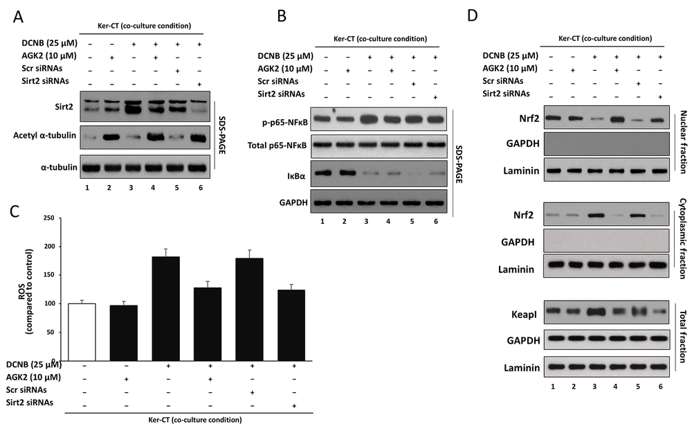 Genetic validation of SIRT2 involvement and assessment of AGK2-alone baseline effects in DNCB-stimulated Ker-CT keratinocytes Ker-CT keratinocytes were maintained in transwell co-culture with CCD-1064Sk fibroblasts and assigned to: G1 vehicle control; G2 AGK2 alone; G3 DNCB; G4 DNCB + AGK2; G5 DNCB + siCtrl; G6 DNCB + siSIRT2. A, SIRT2 knockdown and target engagement were verified by Western blotting for SIRT2 and Ac-α-tubulin; total α-tubulin and GAPDH served as loading controls; densitometry was normalized to vehicle control. B, Basal and stimulated NF-κB signaling was assessed by Western blotting for phospho-p65 (Ser536), total p65, and IκBα. C, ROS levels were quantified by DCFDA fluorescence and normalized to vehicle control. D, Nrf2–Keap1 axis: Nrf2 localization was assessed by nuclear–cytoplasmic fractionation, and Keap1 abundance was assessed in whole-cell lysates. Data are mean ± SD from ≥ 3 independent biological experiments (n ≥ 3). Statistical testing: one-way ANOVA with Tukey’s post hoc test. Where shown, horizontal comparison bars denote statistical contrasts (black bars: vs vehicle control; grey bars: vs DNCB alone). Genetic validation of SIRT2 involvement and assessment of AGK2-alone baseline effects in DNCB-stimulated Ker-CT keratinocytes Ker-CT keratinocytes were maintained in transwell co-culture with CCD-1064Sk fibroblasts and assigned to: G1 vehicle control; G2 AGK2 alone; G3 DNCB; G4 DNCB + AGK2; G5 DNCB + siCtrl; G6 DNCB + siSIRT2. A, SIRT2 knockdown and target engagement were verified by Western blotting for SIRT2 and Ac-α-tubulin; total α-tubulin and GAPDH served as loading controls; densitometry was normalized to vehicle control. B, Basal and stimulated NF-κB signaling was assessed by Western blotting for phospho-p65 (Ser536), total p65, and IκBα. C, ROS levels were quantified by DCFDA fluorescence and normalized to vehicle control. D, Nrf2–Keap1 axis: Nrf2 localization was assessed by nuclear–cytoplasmic fractionation, and Keap1 abundance was assessed in whole-cell lysates. Data are mean ± SD from ≥ 3 independent biological experiments (n ≥ 3). Statistical testing: one-way ANOVA with Tukey’s post hoc test. Where shown, horizontal comparison bars denote statistical contrasts (black bars: vs vehicle control; grey bars: vs DNCB alone).