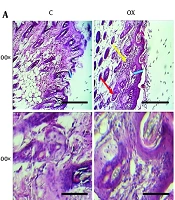 Protective Effect of Soy Lecithin Liposomes in Oxazolone-Induced Dermatitis in a Mouse Model: A Comparative Evaluation