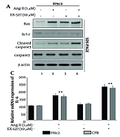 Pharmacological SIRT1 Inhibition Exacerbates Angiotensin II-Induced Myocardial Injury and Is Associated with Dysregulation of the p53-FOXO3a Stress-Response Axis