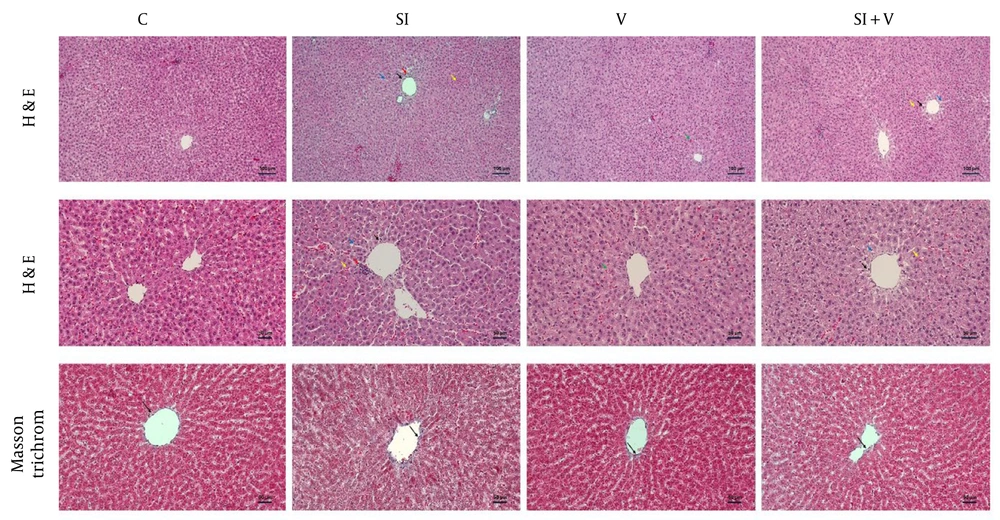 Representative liver sections from the Control (C), Social Isolation (SI), Vortioxetine (V), and Social Isolation + Vortioxetine (SI+V) groups are shown from left to right. The first and second rows display hematoxylin-eosin-stained sections with scale bars of 100 µm and 50 µm, respectively, while the third row shows Masson's trichrome staining with a 50 µm scale bar. Black arrows indicate hepatocytes with pyknotic nuclei, red arrows indicate inflammatory cell infiltration, blue arrows indicate sinusoidal dilatation, yellow arrows indicate erythrocyte extravasation, and long black arrows mark collagen-positive areas. Quantitative analysis of collagen-positive area percentages using Fiji/ImageJ showed no statistically significant differences between groups (Kruskal-Wallis test, P = 0.68). Abbreviations: C, Control; SI, Social Isolation; V, Vortioxetine; SI+V, Social Isolation + Vortioxetine. Representative liver sections from the Control (C), Social Isolation (SI), Vortioxetine (V), and Social Isolation + Vortioxetine (SI+V) groups are shown from left to right. The first and second rows display hematoxylin-eosin-stained sections with scale bars of 100 µm and 50 µm, respectively, while the third row shows Masson's trichrome staining with a 50 µm scale bar. Black arrows indicate hepatocytes with pyknotic nuclei, red arrows indicate inflammatory cell infiltration, blue arrows indicate sinusoidal dilatation, yellow arrows indicate erythrocyte extravasation, and long black arrows mark collagen-positive areas. Quantitative analysis of collagen-positive area percentages using Fiji/ImageJ showed no statistically significant differences between groups (Kruskal-Wallis test, P = 0.68). Abbreviations: C, Control; SI, Social Isolation; V, Vortioxetine; SI+V, Social Isolation + Vortioxetine.
