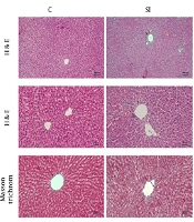 Hepatic Inflammation and Apoptosis in Socially Isolated Rats: Effects of Vortioxetine Treatment