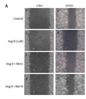 Metformin Attenuates Angiotensin II-Induced Cardiac Inflammaging-Like Injury Through Coordinated Nrf2 Activation and NF-κB Suppression