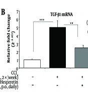 Hesperetin Attenuates Liver Fibrosis in Mice by Modulating Selected Gut Microbial Populations and SIRT2-Associated Inflammatory Signaling
