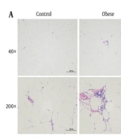 Lyoniresinol Improves Insulin Sensitivity and Induces White-to-Beige Adipose Tissue Conversion in Obese Rats: Associated with JNK/PI3K/mTOR Pathway Modulation