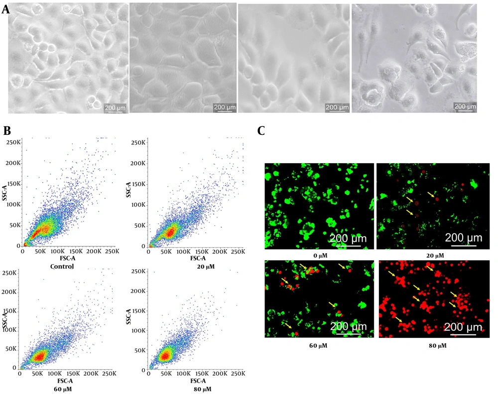 A, Phase-contrast microscopy revealing dose-dependent apoptotic morphological changes, including cell shrinkage, detachment, and membrane blebbing. B, Flow cytometric FSC/SSC analysis indicating progressive reduction in cell size and complexity consistent with apoptosis. C, AO/EB staining confirming increased apoptotic populations with chromatin condensation, fragmentation, and late-stage apoptotic features. A, Phase-contrast microscopy revealing dose-dependent apoptotic morphological changes, including cell shrinkage, detachment, and membrane blebbing. B, Flow cytometric FSC/SSC analysis indicating progressive reduction in cell size and complexity consistent with apoptosis. C, AO/EB staining confirming increased apoptotic populations with chromatin condensation, fragmentation, and late-stage apoptotic features.