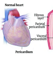 Recent Progress in PET and SPECT Myocardial Perfusion Imaging: From Radiopharmaceuticals to Imaging Innovations