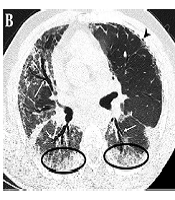 Iranian Journal of Radiology