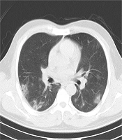 A Multi-centric Evaluation of Deep Learning Models for Segmentation of COVID-19 Lung Lesions on Chest CT Scans