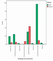 Successful Stereotactic-Guided Vacuum-Assisted Biopsy in the Evaluation of Breast Microcalcifications: A Study in a Single Tertiary Referral Center in the Middle East