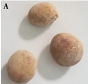 A Study Toward Automatic Identification of Renal Stone Composition in Single-energy or Ultra-low-dose CT Scan Using Deep Neural Networks