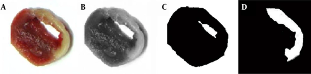 TTC-stained photographs (A) were converted to gray images (B) and classified according to two thresholds (shown as histogram peaks). The total myocardium area (C) and myocardial infarction area (D) can be seen. TTC-stained photographs (A) were converted to gray images (B) and classified according to two thresholds (shown as histogram peaks). The total myocardium area (C) and myocardial infarction area (D) can be seen.