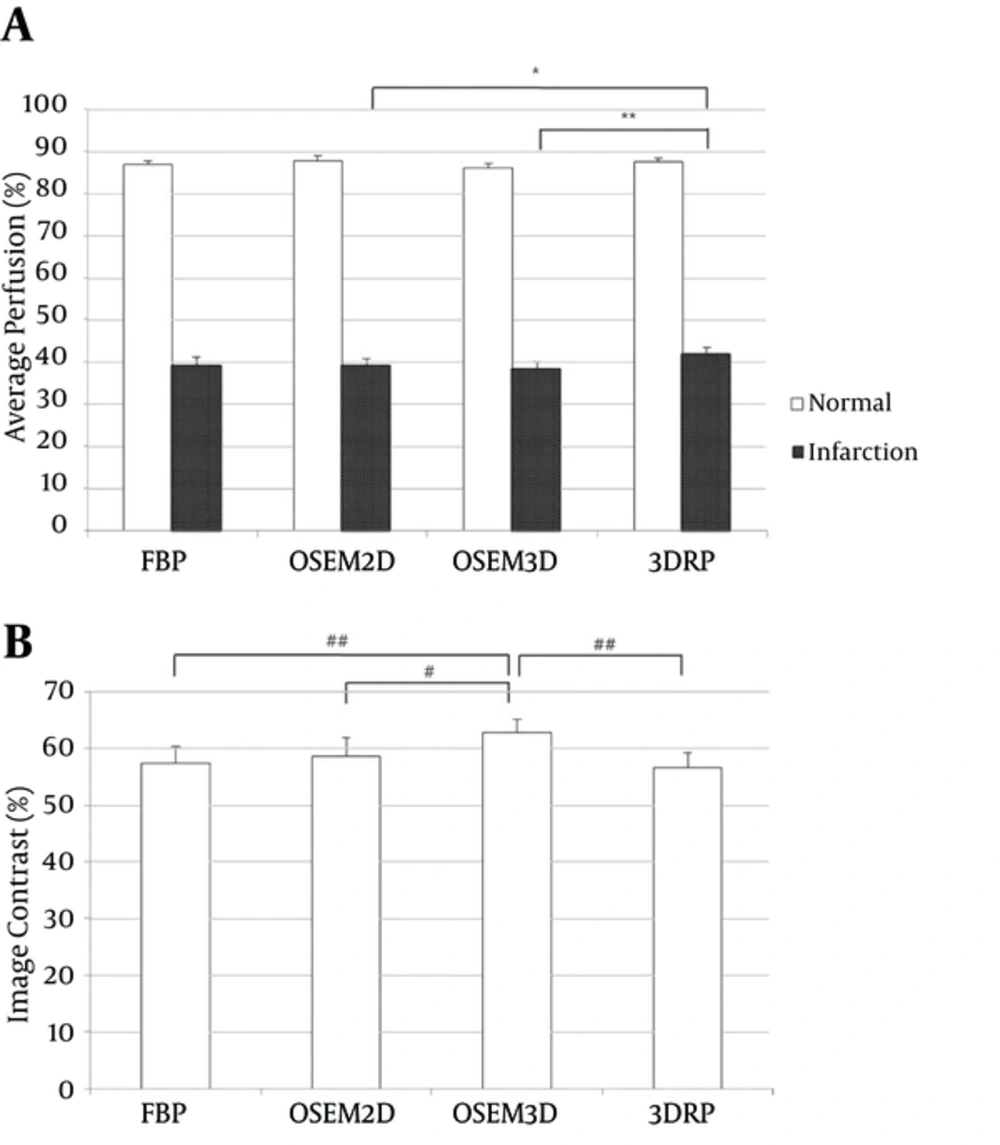 Average perfusion (A) and image contrast (B) for FBP, OSEM2D, OSEM3D, and 3DRP. The average perfusion of normal and infarct areas was measured on the polar maps. Image contrast was calculated using the Michelson contrast formula (see methods) (Abbreviations: FBP; filtered back-projection, 3DRP; three dimensional reprojection algorithm, OSEM2D, two-dimensional ordered subsets expectation maximization; OSEM3D, three-dimensional ordered subsets expectation maximization). Average perfusion (A) and image contrast (B) for FBP, OSEM2D, OSEM3D, and 3DRP. The average perfusion of normal and infarct areas was measured on the polar maps. Image contrast was calculated using the Michelson contrast formula (see methods) (Abbreviations: FBP; filtered back-projection, 3DRP; three dimensional reprojection algorithm, OSEM2D, two-dimensional ordered subsets expectation maximization; OSEM3D, three-dimensional ordered subsets expectation maximization).