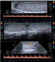 Testicular Microvascular Function in Obese and Non-obese, Fertile and Infertile Men: A Four-Group Comparative Study