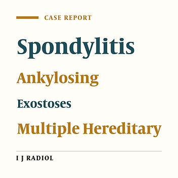 Coexistence of Ankylosing Spondylitis and Hereditary Multiple Exostoses:Coincidence or Association