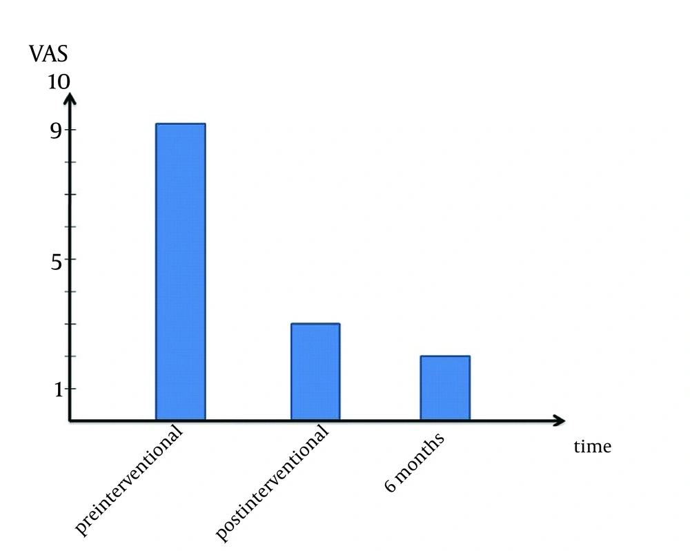 Development of the fracture-related pain on a visual analogue scale (no pain = 0, maximum pain = 10) in the so far observed period. Development of the fracture-related pain on a visual analogue scale (no pain = 0, maximum pain = 10) in the so far observed period.