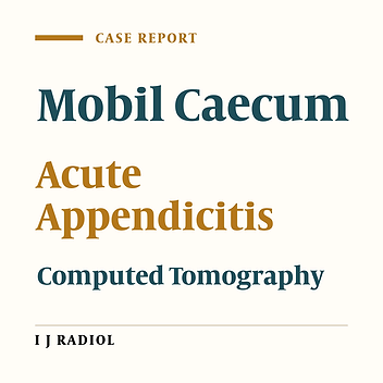 Gangrenous Appendicitis in a Boy with Mobile Caecum