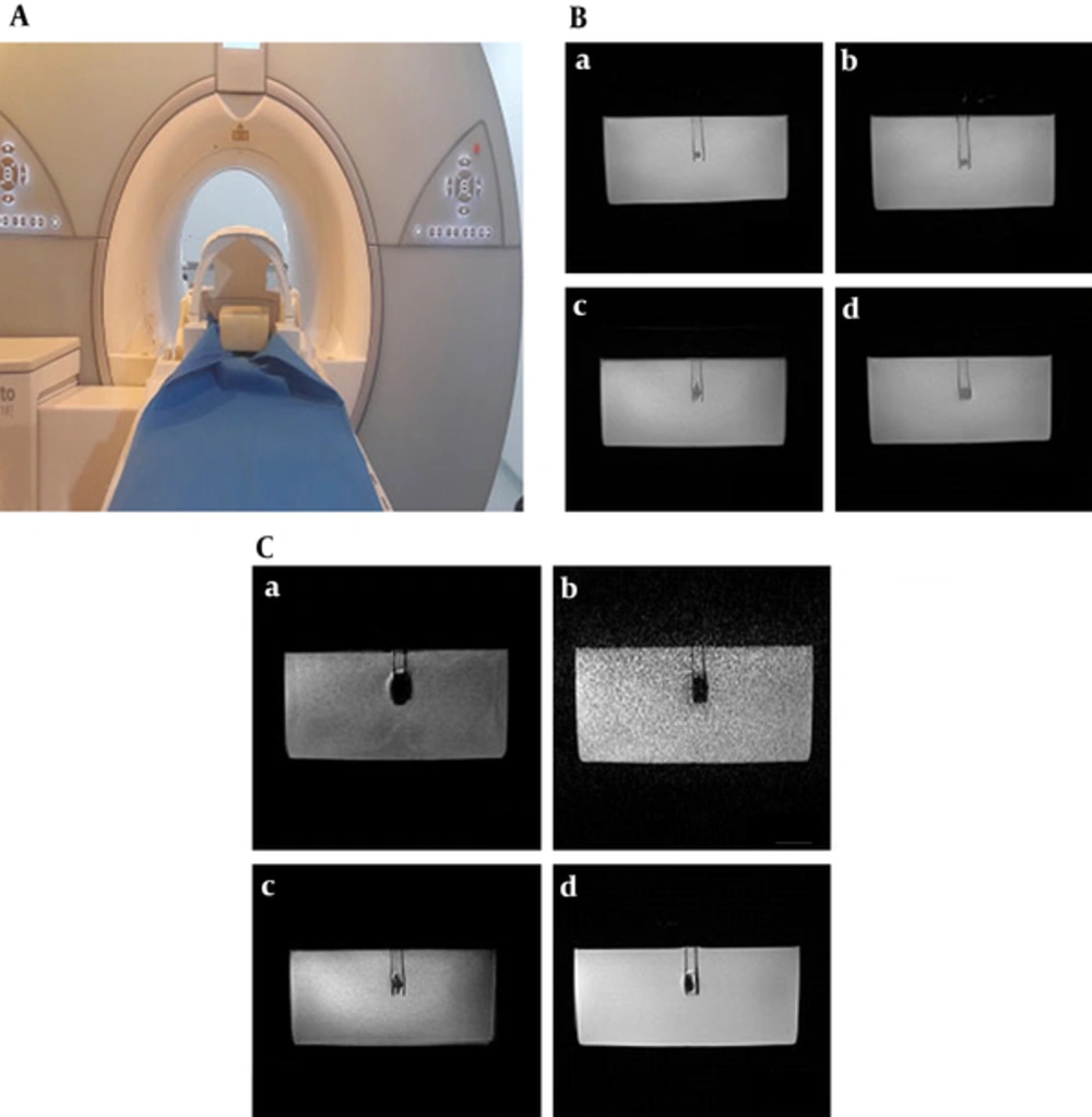 Sample imaging and artifact analysis. A, Phantom filled with paraffin and the dental material placed at the center; B, T1 weighted depiction of ceramic (a), dycal (b), Ti implant (c) and Nickel-chromium (d) materials inside a paraffin phantom acquired by sampling perfection with application optimized contrasts using different flip angle evolution (SPACE) SPACE pulse sequence; C, Artifact representations of the Ti implant acquired by TW Three dimensional fast low-angle shot (3D-FLASH) (a), T2W three-dimensional volumetric interpolated breath-hold examination (3D VIBE) (b), T1W 3D SPACE(c) and T1W 2D BLADE(d) pulse sequences. Sample imaging and artifact analysis. A, Phantom filled with paraffin and the dental material placed at the center; B, T1 weighted depiction of ceramic (a), dycal (b), Ti implant (c) and Nickel-chromium (d) materials inside a paraffin phantom acquired by sampling perfection with application optimized contrasts using different flip angle evolution (SPACE) SPACE pulse sequence; C, Artifact representations of the Ti implant acquired by TW Three dimensional fast low-angle shot (3D-FLASH) (a), T2W three-dimensional volumetric interpolated breath-hold examination (3D VIBE) (b), T1W 3D SPACE(c) and T1W 2D BLADE(d) pulse sequences.